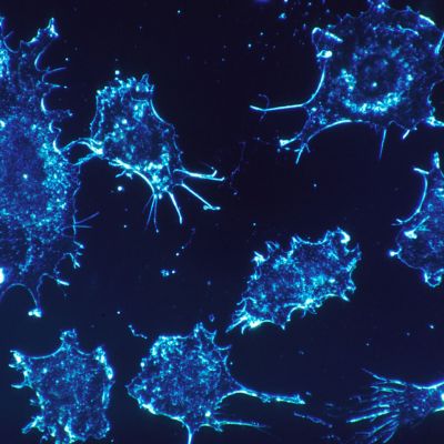 DNA nanoboti z Číny přesně zaměří a zničí nádor