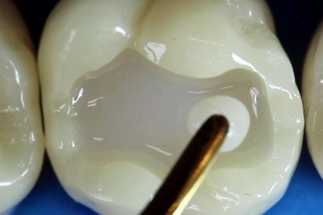 Londýnští vědci naučili zuby opravovat vlastní kazy
