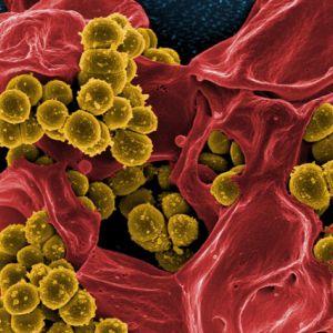 Ultrazvukoví nanoboti vám vyčistí krev od toxinů a bakterií