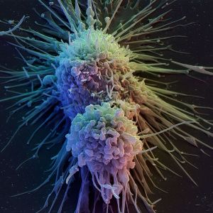 Švýcarští vědci ničí rakovinu uměle vytvořenými viry