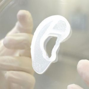 První transplantace 3D vytištěného ucha proběhla úspěšně